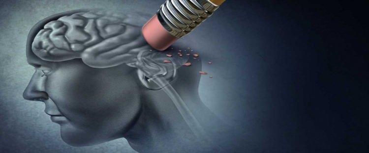 <p><strong>Alzheimer</strong></p>

<p> </p>

<p> </p>
