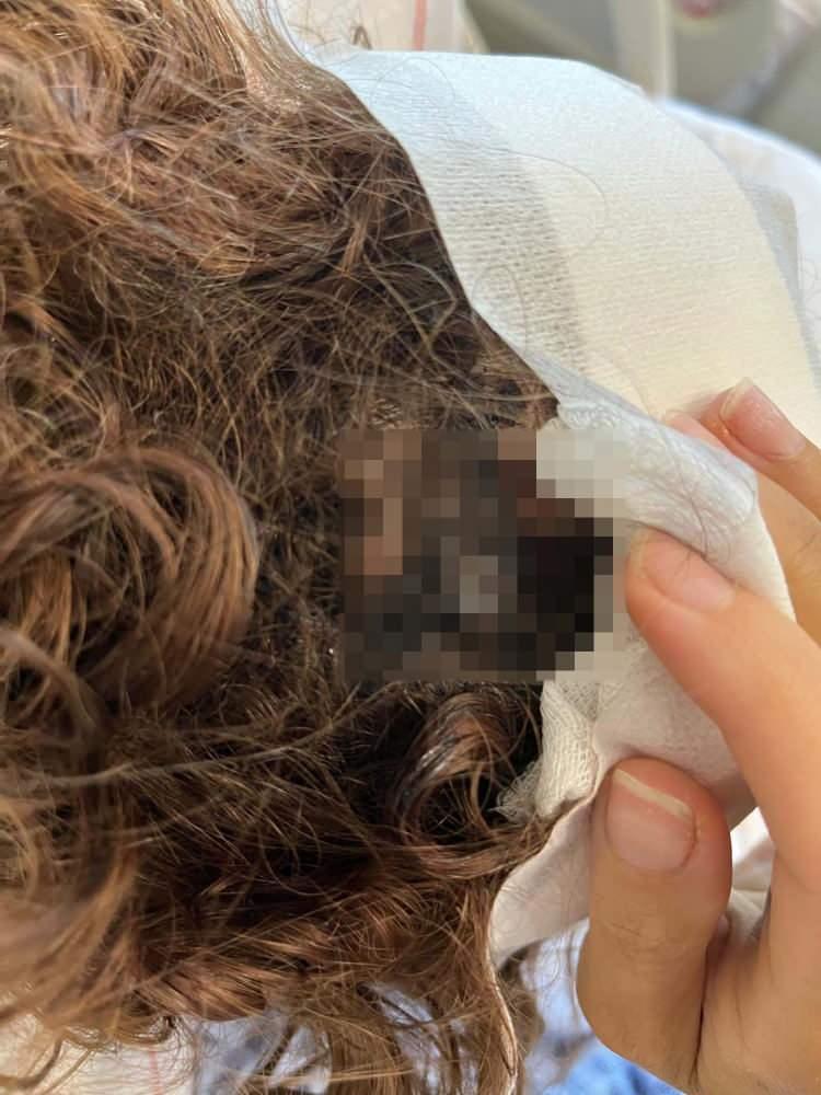 <p>Olay, 5 Temmuz Cumartesi gecesi saat 00.40 sularında Konyaaltı ilçesinde meydana geldi.</p>