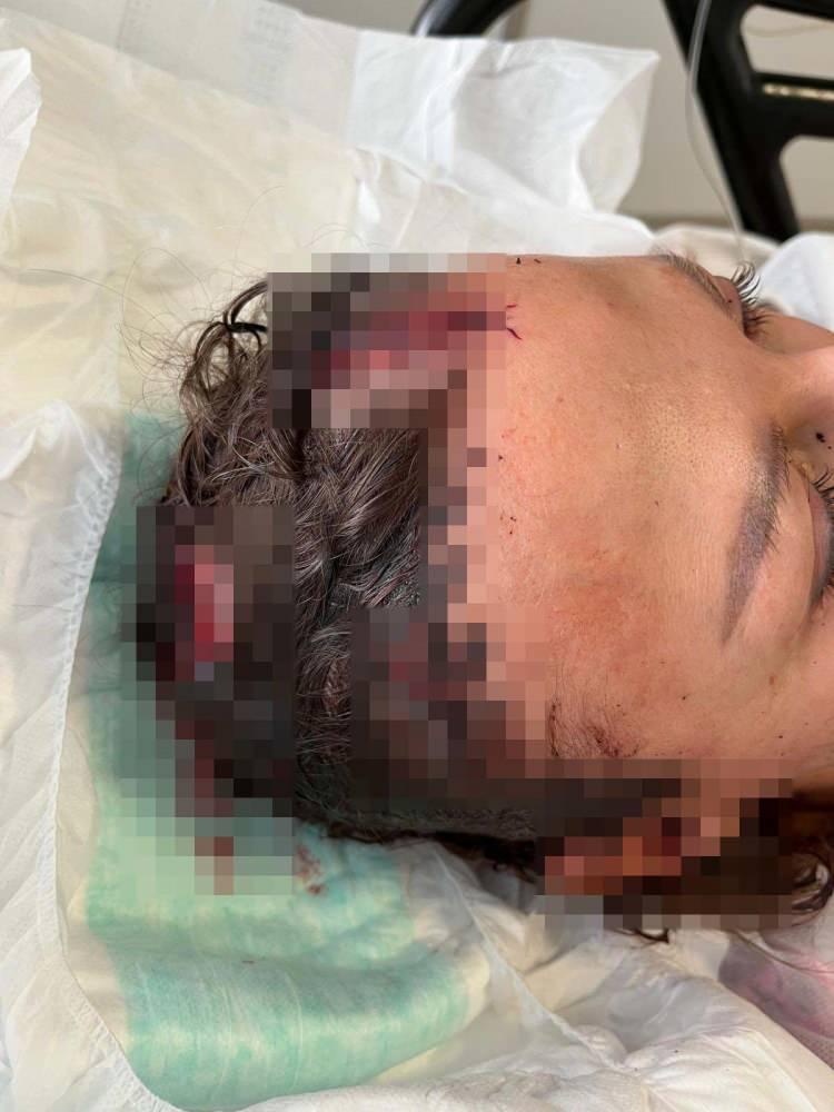 <p>Otelde vardiyalı olarak çalışan Iryna, gece mesaisi sonrası servisten inerek konutunun arka kapısından evine girmek üzereyken arkasında bir ses duydu.</p>
