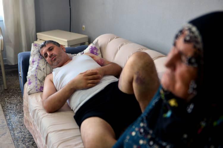 <p>Evde tedavisi süren Mehmet Alpaltun’un, beyin kanaması riskine karşın uyutulmadığı belirtildi. Polis de şüphelinin yakalanması için çalışma başlattı.</p>
