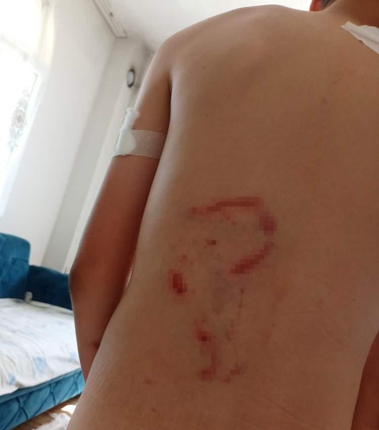 <p>Köpek, kaçmaya çalışan çocuğu önce kalçasından, ardından sırtından ve son olarak da omzundan ısırdı.</p>
