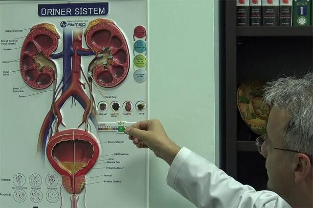 <p>Nakil süreci, hastane bünyesindeki multidisipliner konseyin onayıyla ilerledi. Operasyon yaklaşık 6 saat sürdü ve herhangi bir komplikasyon yaşanmadan başarıyla tamamlandı. Doç. Dr. Umman, Deniz Ağca’nın ameliyat sürecinin medikal açıdan zorlu geçtiğini belirterek şu açıklamayı yaptı:</p>