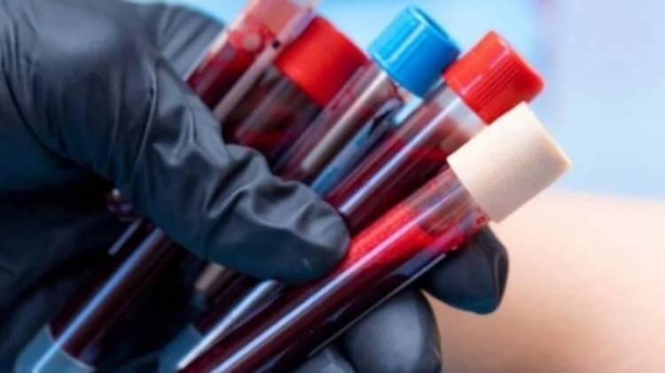 <p>Bu araştırmada, genç sağlıklı bireylerde core stabilite ve soğuk basınç testi uygulanarak,<strong> 0 kan grubu grubunun ağrı toleransının (ortalama 56.48 saniye) diğer gruplardan (A: 45.2, B: 48.5, AB: 40.1)</strong> belirgin şekilde yüksek olduğu saptandı.</p>