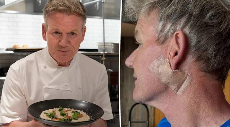 Dünyaca ünlü ödüllü şef Gordon Ramsay cilt kanserine yakalandı!