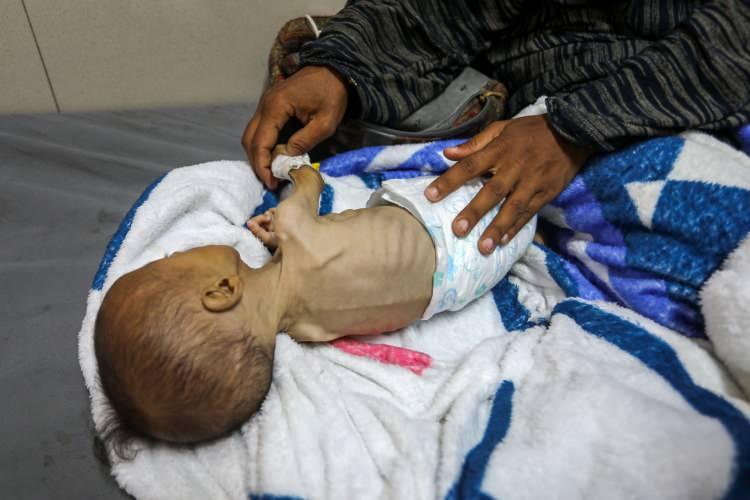 <p>Yetersiz beslenme nedeniyle hayati tehlike yaşayan 2 aylık bebek Eid Ebu Cami, kısıtlı imkanlarla Han Yunus’taki Nasır Hastanesi’nde tedavi ediliyor.</p>

<p> </p>
