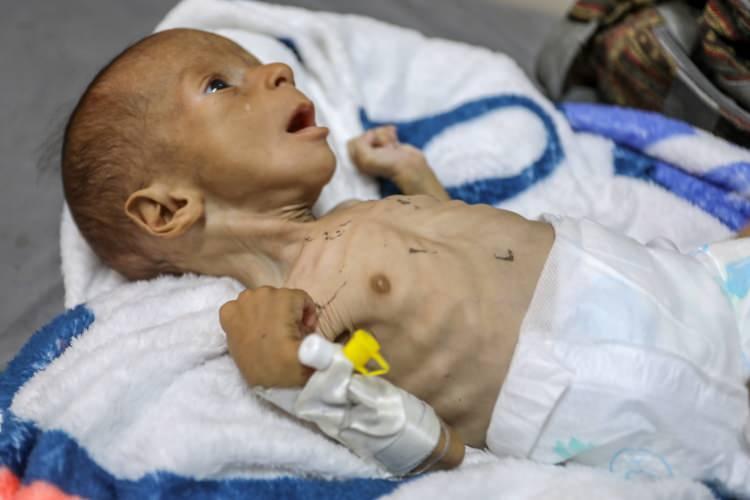 <p>Yaşanan felaketler her geçen gün yeni canlar alırken 2 aylık bebeğin son hali yürekleri dağladı... </p>
