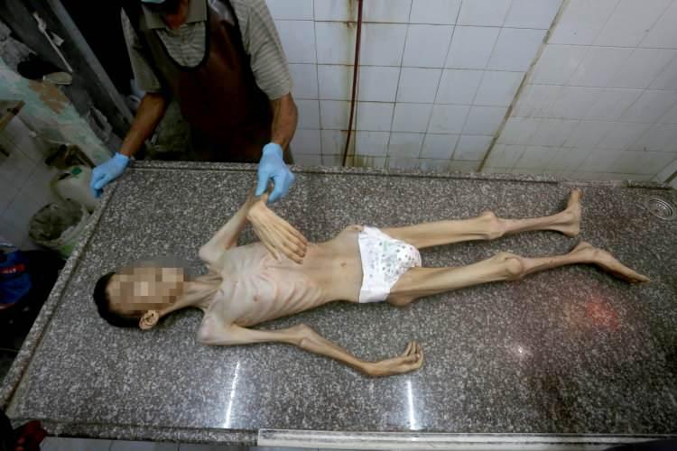 <p>UNRWA'nın, Amerikan X şirketinin sosyal medya platformundaki hesabından yapılan paylaşımda, Gazze'deki çocukların durumuna ilişkin bilgi verildi.</p>

<p> </p>
