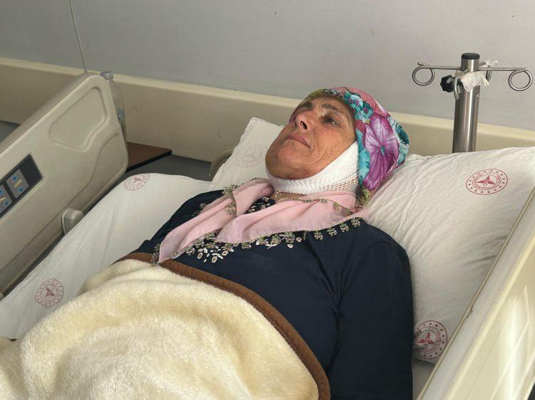<p>ARTIK GÜLÜMSEYEBİLECEK</p>

<p>Hastanın uzun süredir yüz felci şikayeti yaşadığını ve bu durumu da zamanla kabullendiğini dile getiren Kavak, "Ancak son dönemde gelişen tükürük bezi kitlesi hastaneye başvuru sebeplerinden biri oldu. Biz de hastayı bütüncül olarak değerlendirdik; tükürük bezindeki kitleyi, eşlik eden yüz felci ve ağız köşesinde istemsiz kas hareketlerine sebep olan sinkineziyi kendisine aktardık. Bu durumların cerrahi veya bazı durumlarda ilaç tedavisiyle düzeltilebileceğini ifade ettik. Hastamızda cerrahi gerektiren birden fazla durum olduğundan, tükürük bezindeki kitle öncelikli olarak cerrahi yöntemle alındı. Operasyon uzun sürdü, ancak başarılı geçti. Yüz felcinin tedavisi erken dönemde ilaçla mümkün olabilse de, ilerleyen dönemlerde sinir nakilleri veya kas transferleri gibi cerrahi yöntemler gerekmektedir. Hastamızda kısmi yüz felci bulunduğu için yüz hareketlerinin bir kısmı hâlâ mevcuttu. Bu nedenle sinir transferi yapmayı uygun gördük. Ayrıca, istemsiz kas hareketlerine sebep olan sinkinetik sinirleri de iptal ederek, hastamızın gelecekte daha sağlıklı ve doğal bir şekilde gülümseyebilmesini sağlamayı hedefledik" diye konuştu.</p>
