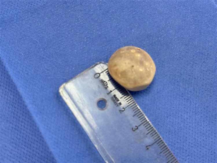 <p><strong>TAŞLAR ÜSTÜNDE İNCELEME YAPILACAK</strong></p>

<p> </p>

<p><strong> En büyüğü 2,5 cm olan 287 taş üzerinde uzmanlar tarafından çeşitli incelemeler yapılacak.</strong></p>
