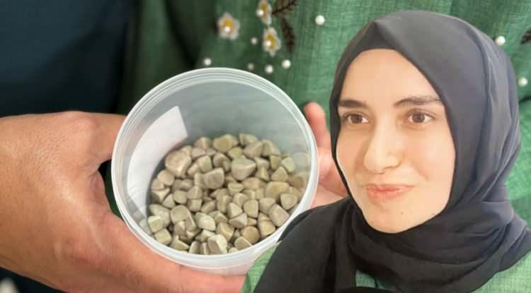 <p><strong>Doğumsal ürolojik hastalıkla dünyaya gelen 21 yaşındaki Fatma Nur Öztürk, şiddetli karın ağrısı şikayetiyle hastaneye gitti. Yapılan operasyonla Öztürk'ün vücudundan 287 adet taş çıkarıldı.</strong></p>
