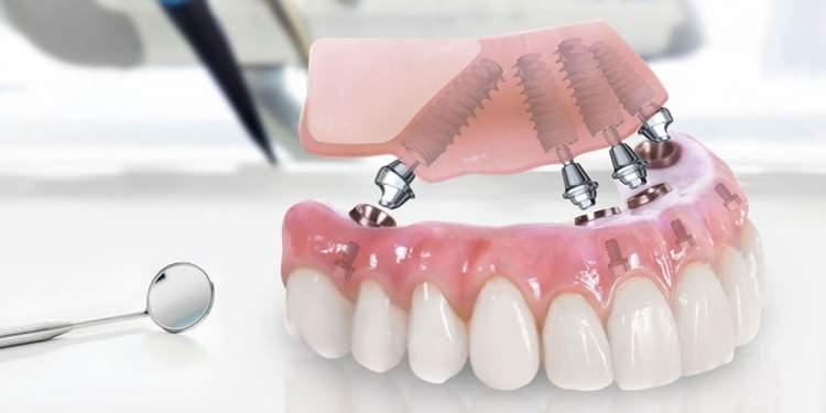 <p>Finlandiya – 1,0</p>

<p> </p>
