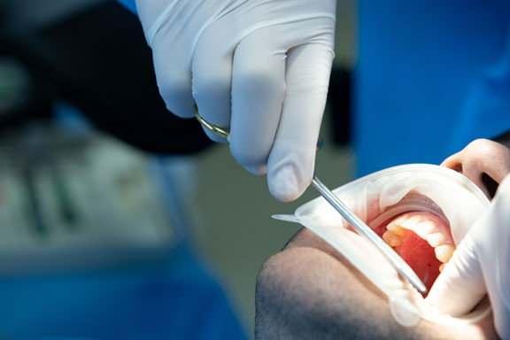 <p>Bazı ülkeler yılda yalnızca bir kez bile diş hekimine uğramazken, üst sıralarda bulunan ülkelerde düzenli kontrollerin hayatın doğal bir parçası olduğu görülüyor.</p>
