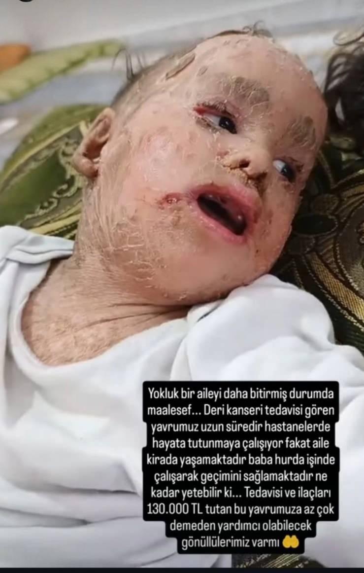 <p>Ancak hiçbir yardımın aileye ulaşmağı ve<strong>bu hesaplardan ailenin de engellediği iddia edildi. </strong></p>

