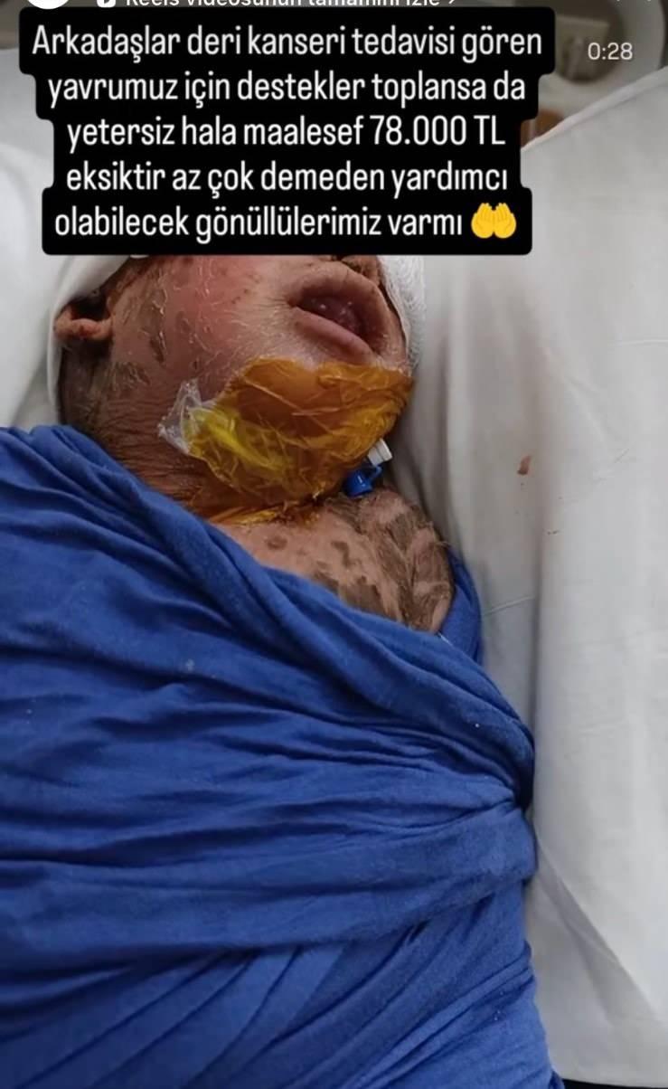 <p><span style="color:#A52A2A"><strong>YÜZ BİNLERCE LİRA TOPLANDI </strong></span></p>

<p>Çalınan hesaptaki fotoğraf ve videolar başka yardım sayfalarında paylaşıldı ve<strong> yüz binlerce lira Yusuf adına toplanıldığı öne sürüldü. </strong></p>
