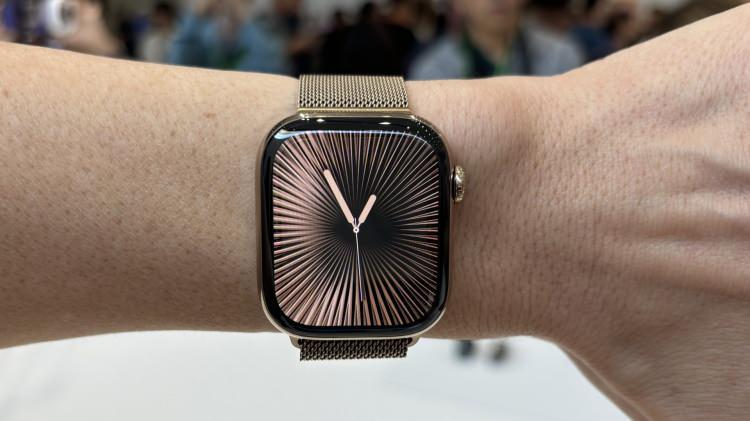<p><span style="color:#B22222"><strong>APPLE WATCH</strong></span></p>

