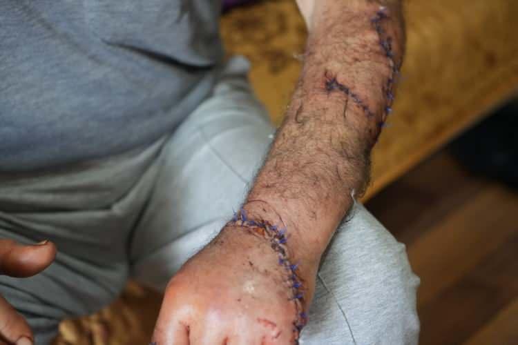 <p>Polis ekipleri tarafından gözaltına alınan eşi Z.T. ise <strong>"kasten öldürmeye teşebbüs" </strong>suçlamasıyla çıkarıldığı mahkemece tutuklandı.</p>

