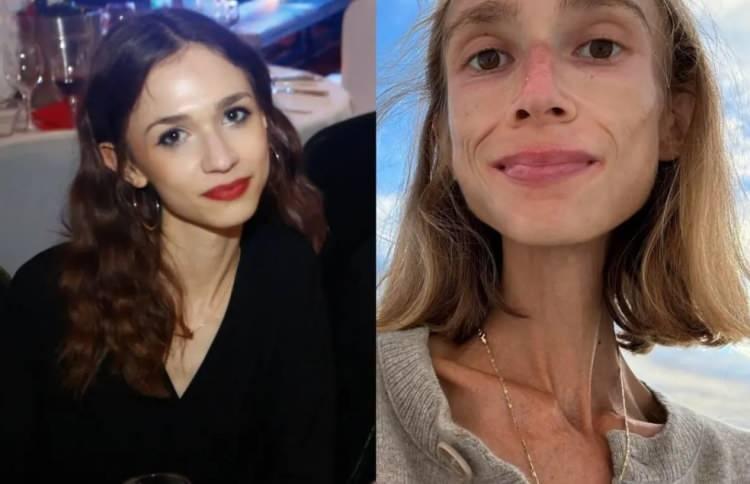 <p><strong>Ergenlik çağından itibaren sağlıklı beslenme konusunda sorunlar yaşayan ünlü isim, eğitim için İngiltere'ye taşındığında vegan beslenme tarzı seçti ve yaşam tarzını sosyal medya hesabından paylaşmaya başladı.</strong></p>