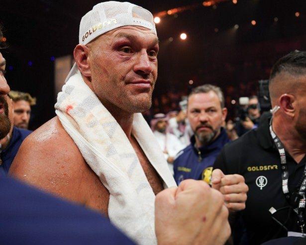 <p>3. Tyson Fury (146 milyon $)</p>
