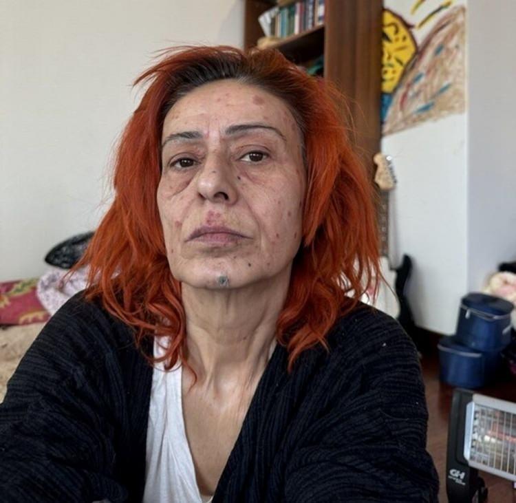 <p>Acıyla uyanan şarkıcıya konakladığı otelde hemen müdahale yapıldı.</p>
