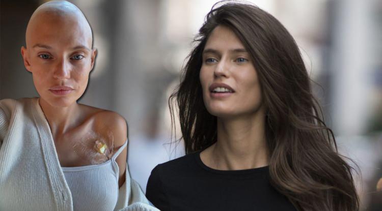 <p><span style="color:#800080"><strong><em>Victoria's Secret defilelerinde yıllarca yer alan İtalyan model Bianca Balti, yumurtalık kanseriyle mücadelesine dikkat çekmek için yeniden podyuma çıkmak istedi. Ancak marka, "Kadro tamamlandı." diyerek teklifi reddetti.</em></strong></span></p>