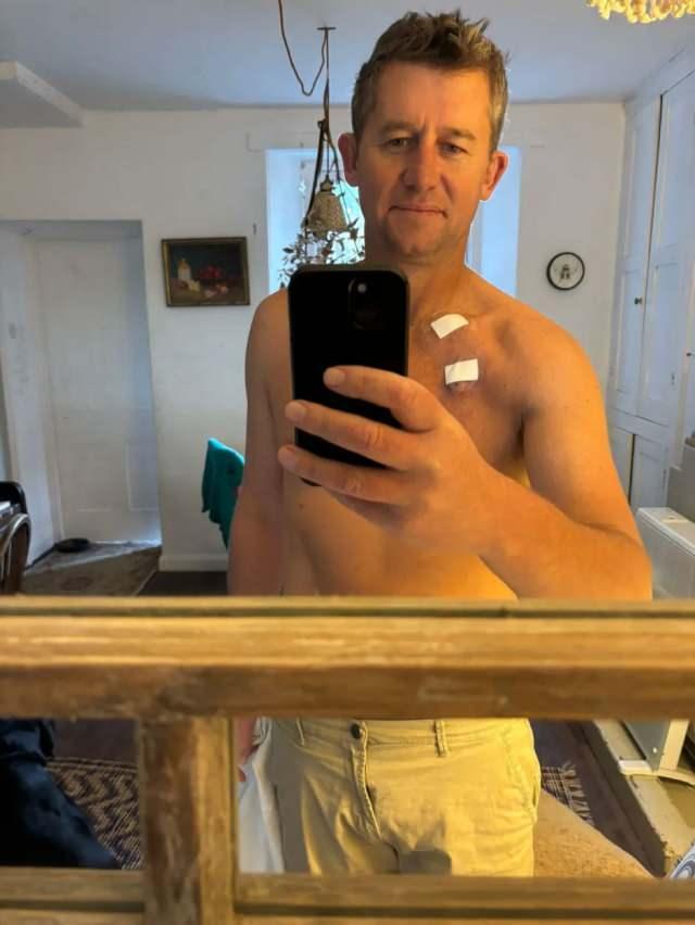 <p><strong>GER&Ccedil;EK MERDİVENDE YIĞILINCA ORTAYA &Ccedil;IKTI</strong><br />
Bir gece evinde merdiven &ccedil;ıkarken aniden yere yığılan Zack, kan kusmaya başladı. Eşi Jess'in hızlı m&uuml;dahalesiyle ambulans &ccedil;ağrıldı ve Zack acil olarak hastaneye kaldırıldı. Burada yapılan detaylı tetkiklerde, yemek borusunda yaklaşık 6 santimetre b&uuml;y&uuml;kl&uuml;ğ&uuml;nde bir t&uuml;m&ouml;r tespit edildi. Sonu&ccedil;lar, Zack'in 4. evre yemek borusu kanseriyle karşı karşıya olduğunu ortaya koydu.</p>
