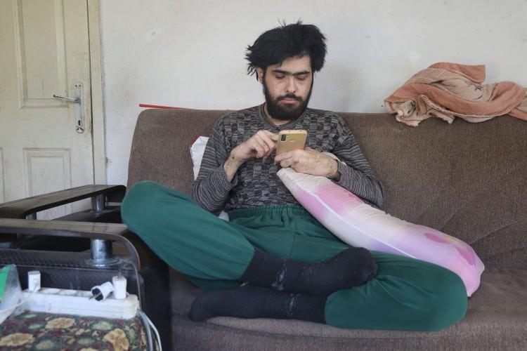 <p>Evin dışına 3 yıla yakın süredir tek adım dahi atmayan Barış'ın annesi Semra Özbay, evladı için her gün acı çekiyor. Telefonla ve bilgisayarla oynamaktan boynunu dahi çeviremeyen Barış'ın yeniden hayata tutunması için acılı annesi destek bekliyor.</p>
