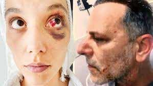 <p>Şiddet iddialarının gündeme geldiği dönemde "<strong>Babil"</strong> dizisinde rol alan <strong>Ozan Güven</strong>, kamuoyundan gelen yoğun tepkiler üzerine diziden ayrılmak zorunda kalmıştı. </p>
