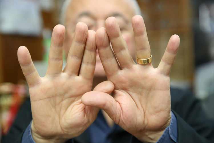 <p>"Nüfus Müdürlüğü'nde ehliyetimi değiştirmek için gittiğimde parmak izi alıyorlar. Defalarca bastır, bastır, bastır, bir türlü parmak izinin 8 tanesi çıkmıyor, sadece 2 tanesi çıkıyor. 'Ne iş yapıyorsun?' diye sorunca 'Ben gözlükçüyüm.' dedim.</p>