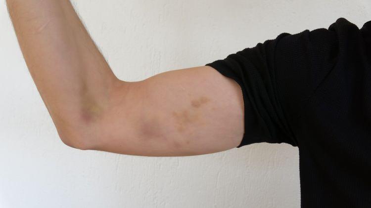 <p>Çıkan tartışmanın ardından Bucak Belediyesi Başkan Yardımcısı H.G., CHP Bucak Belediye Meclis Üyesi Ö.D. ve zabıta personellerinin bulunduğu 23 kişilik grup Şengül'ün işyerinin bulunduğu binaya geldi. </p>