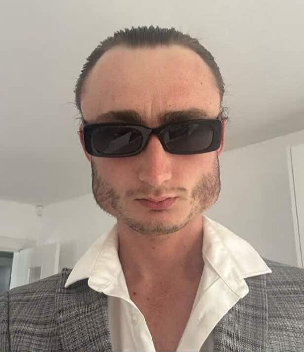 <p><span style="color:#800080"><strong>DOKTORLAR ESTETİK MÜDAHALE ÖNERDİ</strong></span></p>
