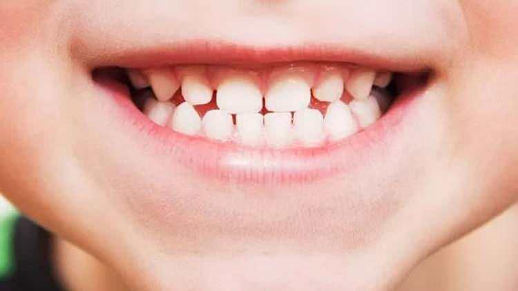 <p><span style="color:inherit"><strong>160 PSİ</strong></span></p>

<p> </p>
