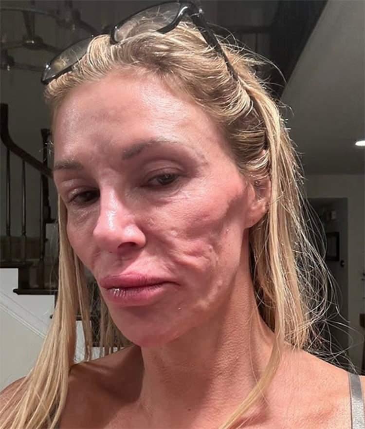 <p><span style="color:#FF0000"><strong>FAS'TA PARAZİT KAPTIĞINDAN ŞÜPHELENİYORDU</strong></span></p>

<p><strong>"Bazen oturduğum yerden kalkmak bile istemiyorum. Sanki bu hayatı bu şekilde yaşamak istemiyormuşum gibi geliyor. Dışarı çıkmıyorum ve tüm paramı sorunumun ne olduğunu anlamaya çalışarak harcıyorum." diyerek üzüntüsünü paylaşan Glanville, daha önce yaptığı açıklamada sebebin parazit olabileceğinden şüphelendiğini söylemişti.</strong></p>
