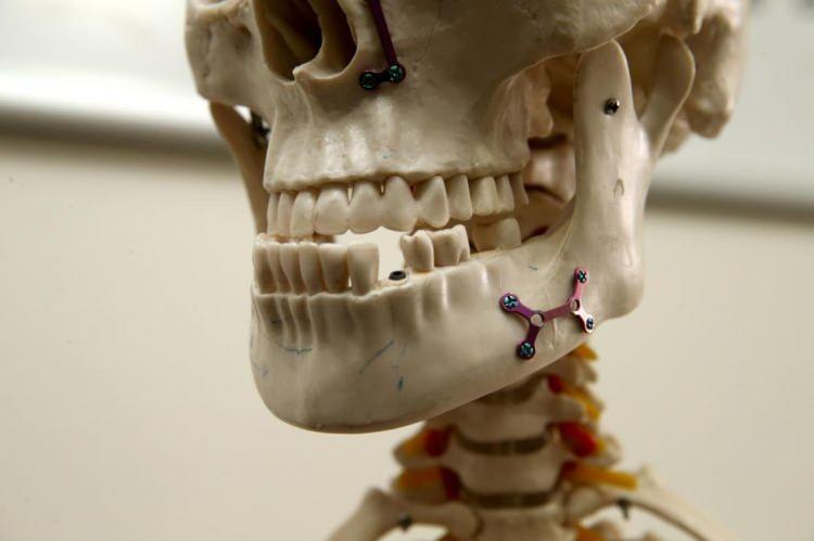 <p><span style="color:#B22222"><strong>İMPLANT TEDAVİSİNİN SSK KAPSAMINA ALINMASI İÇİN KANUN TEKLİFİ</strong></span></p>

<p><br />
İmplant tedavisinin SSK kapsamına alınması için TBMM'ye kanun teklifi sunuldu.</p>

<p> </p>
