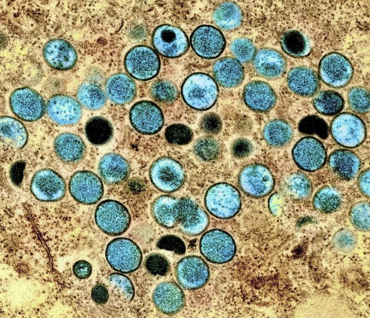 <p><span style="color:#B22222"><strong>“ÜLKEMİZE GELMESİ ÇOK ZAMAN ALMAYACAK”</strong></span></p>

<p> </p>

<p>Risk gruplarının aşılanması gerektiğine dikkat çeken Prof. Dr. Özlü, 'H3N2' virüsünün yakın zamanda Türkiye’de de görülme olasılığının yüksek olduğunu kaydederek, <strong><em>"Özellikle 5 yaş altında ve 50 yaş üzerinde grip virüslerinin ağır seyrettiğini komplike ve ölümcül olabildiğini zaten biliyoruz.</em></strong></p>
