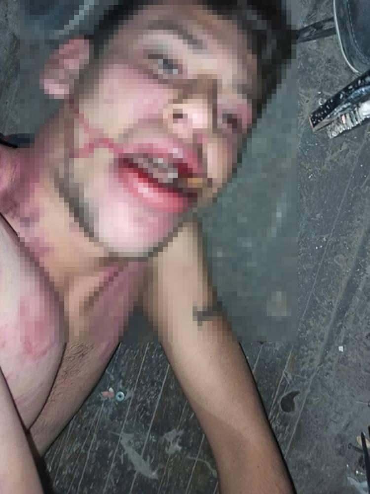 <div>DİŞLERİNİ KIRIP HAMAM BÖCEĞİ YEDİRMİŞLER</div>

<div> </div>

<div> </div>

<div>Dişleri kırılan, vücudunda kesikler oluşan Kurt'un elleri ve kolları bağlandı, hamam böceği yedirildi. Şüpheliler, yaptıkları işkenceyi cep telefonuyla da kaydetti. Daha sonra iş yerinden kaçan Kurt, şüphelilerin cep telefonundaki işkence görüntülerine ulaşarak, şikayetçi oldu.</div>
