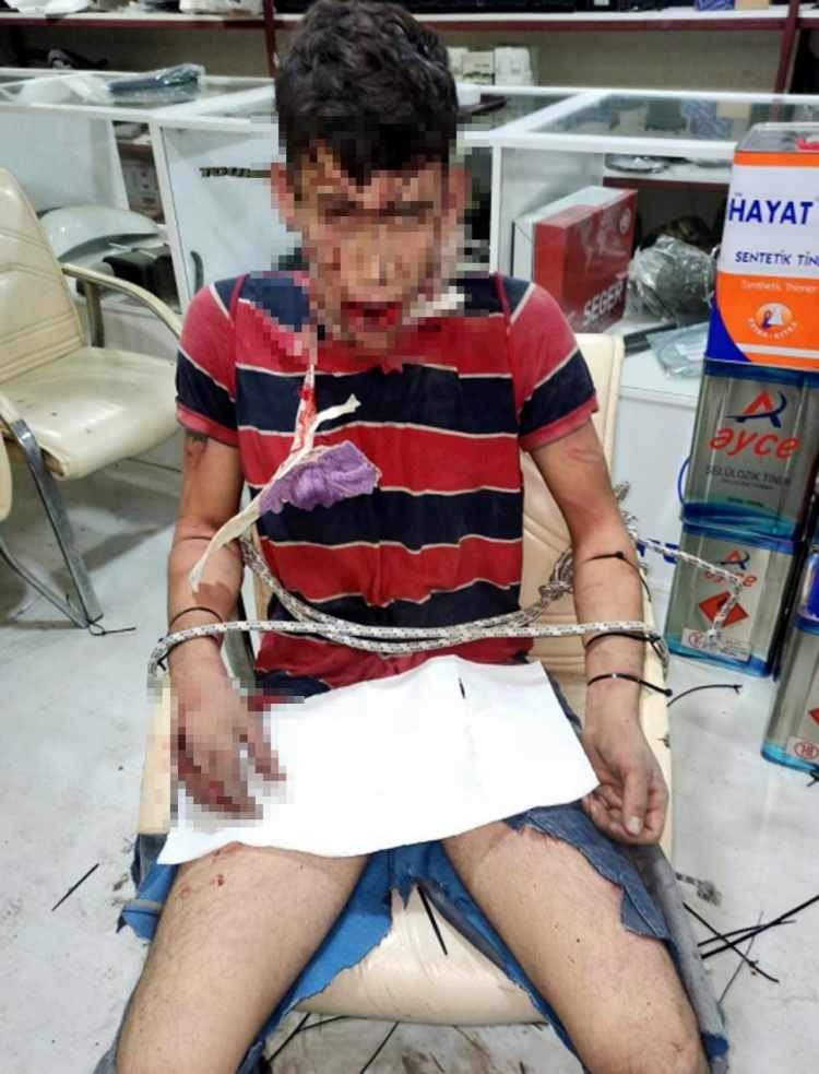 <p><span style="color:#B22222"><strong>SANDALYEYE BAĞLAYIP 3 GÜN BOYUNCA İŞKENCE ETTİLER</strong></span></p>

<p><br />
Kurt, Antalya'ya dönerek aldığı 15 bin lirayı iş yeri sahiplerine teslim etti. İddiasına göre iş yerinde A.T., O.T., S.T. ve A.A. tarafından depoya kilitlenerek sandalyeye bağlanan genç, 3 gün boyunca işkenceye maruz kaldı.</p>
