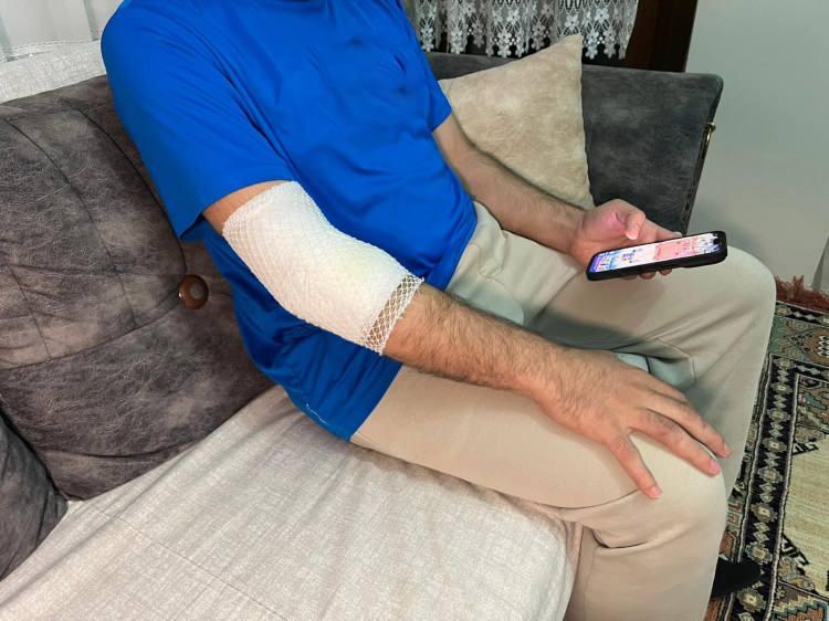 <p>İddiaya göre, sitede özel güvenlik olarak çalışan <span style="color:#A52A2A"><strong><em>Semih Anıl Cansız,</em></strong></span> site sakinlerinden Demet D.K. isimli kadının Golden cinsi köpeği tarafından saldırıya uğradı.</p>
