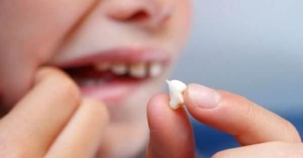 <p><span style="color:#B22222"><strong>EN FAZLA G&Ouml;R&Uuml;LEN R&Uuml;YA: DİŞ D&Ouml;K&Uuml;LME R&Uuml;YASI OLDU</strong></span></p>

<p>&nbsp;</p>

<p>Verileri baktığımızda d&uuml;nyada en fazla g&ouml;r&uuml;len r&uuml;yanın <strong>&ldquo;diş d&ouml;k&uuml;lmesi r&uuml;yası</strong>&rdquo; olduğu ortaya &ccedil;ıkıyor.</p>

<p>&nbsp;</p>

<p><span style="color:#B22222"><strong>Diş d&ouml;k&uuml;lmesi r&uuml;yasının en &ccedil;ok g&ouml;r&uuml;ld&uuml;ğ&uuml; &uuml;lkeler:</strong></span></p>

<p>&nbsp;</p>

<p>Avustralya, ABD, Birleşik Krallık, Kanada, İrlanda, Hollanda, Yeni Zelanda, Norve&ccedil;, İspanya, İsve&ccedil;, Birleşik Arap Emirlikleri</p>
