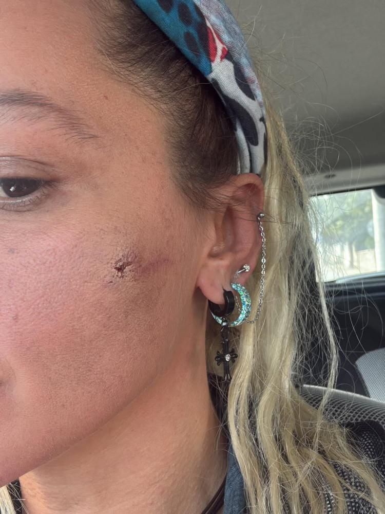 <p><strong>Yüzünde ve boynunda oluşan morlukların fotoğraflarını</strong> yayımlayan oyuncu, 7 aylık eşi tarafından darp edildiğini ifade etti.</p>
