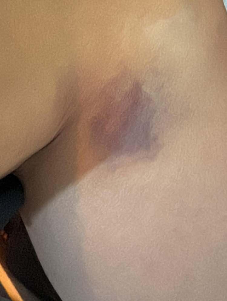 <p>Asyalı'nın paylaşımı kısa sürede sosyal medyada geniş yankı uyandırırken, ünlü ismin Demirci hakkında <strong>uzaklaştırma kararı</strong> aldırdığı öğrenildi.</p>
