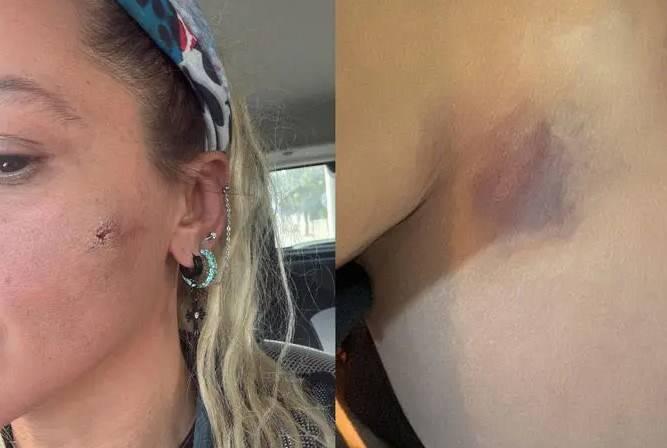 <p>Asyalı, darb edildiğine dair yaptığı paylaşımda, <strong>"Kocam tarafından darp edildim"</strong> a&ccedil;ıklamasında bulundu.&nbsp;</p>
