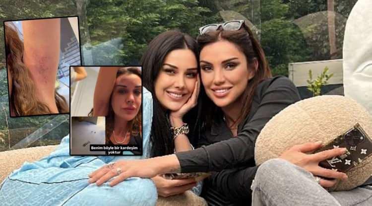 Dilan Polat, ablası Sıla Doğu tarafından darp edildiğini iddia etti!