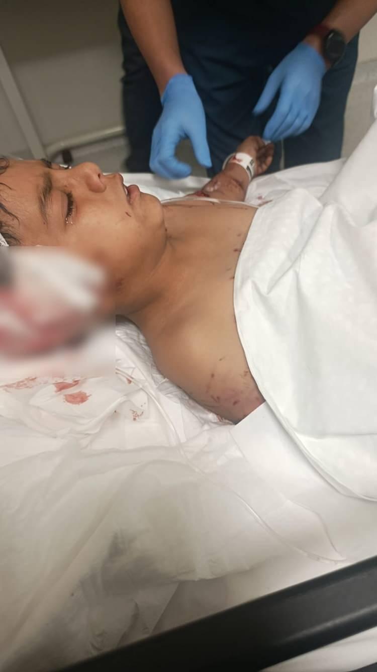 <p>&Ccedil;ocuğun &ccedil;ığlıklarını duyan &ccedil;evredekiler, k&ouml;pekleri uzaklaştırdı.&nbsp;</p>

<p>&nbsp;</p>

<p>İhbar &uuml;zerine olay yerine sağlık ekipleri sevk edildi.</p>
