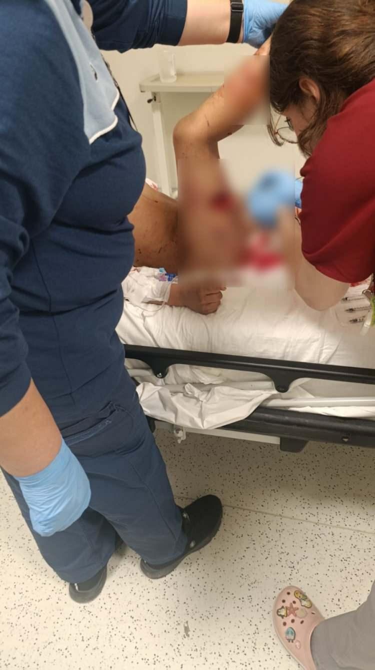 <p><span style="color:#A52A2A"><strong>HAYATİ TEHLİKEYİ ATLATTI&nbsp;</strong></span></p>

<p>&nbsp;</p>

<p>Yaralanan Davut E., ambulansla hastaneye kaldırılarak tedavi altına alındı.</p>

<p>&nbsp;</p>

<p>Hayati tehlikeyi atlattığı &ouml;ğrenilen &ccedil;ocuğun hastanede tedavisi s&uuml;r&uuml;yor.&nbsp;</p>
