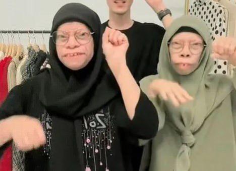 <p><span style="color:#EE82EE"><strong>ALLAH TARAFINDAN BAHŞEDİLMİŞ</strong></span></p>

<p><strong>Ailenin bu fiziksel durumları, hayatlarını ciddi bir şekilde etkilemediği için böyle yaşamakta pek bir problem görmüyorlar. Hatta, ailenin babası<span style="color:#4B0082">&nbsp;<em>"Aslında yüzümüz şekil değiştirmiş ama biz bunu kabul edip onunla yaşıyoruz. Bu durumla büyümek beni aşağılık hissettirdi ama artık böyle hissetmiyorum."</em></span> sözleriyle ifade ediyor. Manurung ailesi, bu durumun Allah tarafından bahşedilmiş bir hediye olduğunu düşünüyor.</strong></p>
