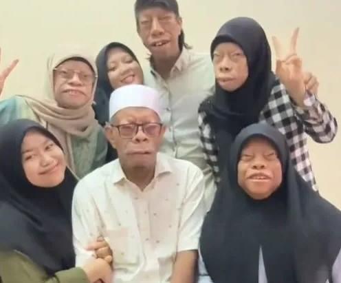 <p><strong>Manurung'lar, bu ve bunun gibi sorunlara sahip başka insanlar olması ihtimaline karşı şu sözleri ekliyor:</strong></p>

<p><strong><em><span style="color:#4B0082">"Bizim durumumuzdaki gibi başka insanlar varsa kendilerini kötü hissetmesin. bir şeylerden vazgeçmesin. kaderi ya da Allah'ı suçlamasın. günahkâr olduğu için böyle olduğunu düşünmesin. dünyaya açılsın ve pozitif düşünsün."</span></em></strong></p>
