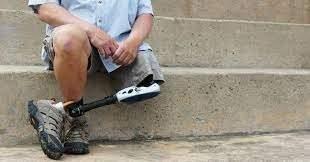 <p><span style="color:#B22222"><strong>FEL&Ccedil; VE UZUV KAYIPLARI</strong></span></p>
