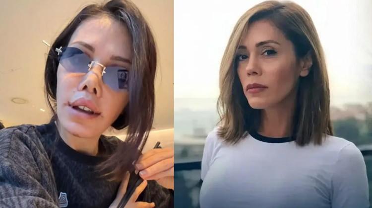 Eski survivor yarışmacısı y&uuml;z nakli oldu! Y&uuml;z&uuml;ndeki değişim herkesi şaşkına uğrattı