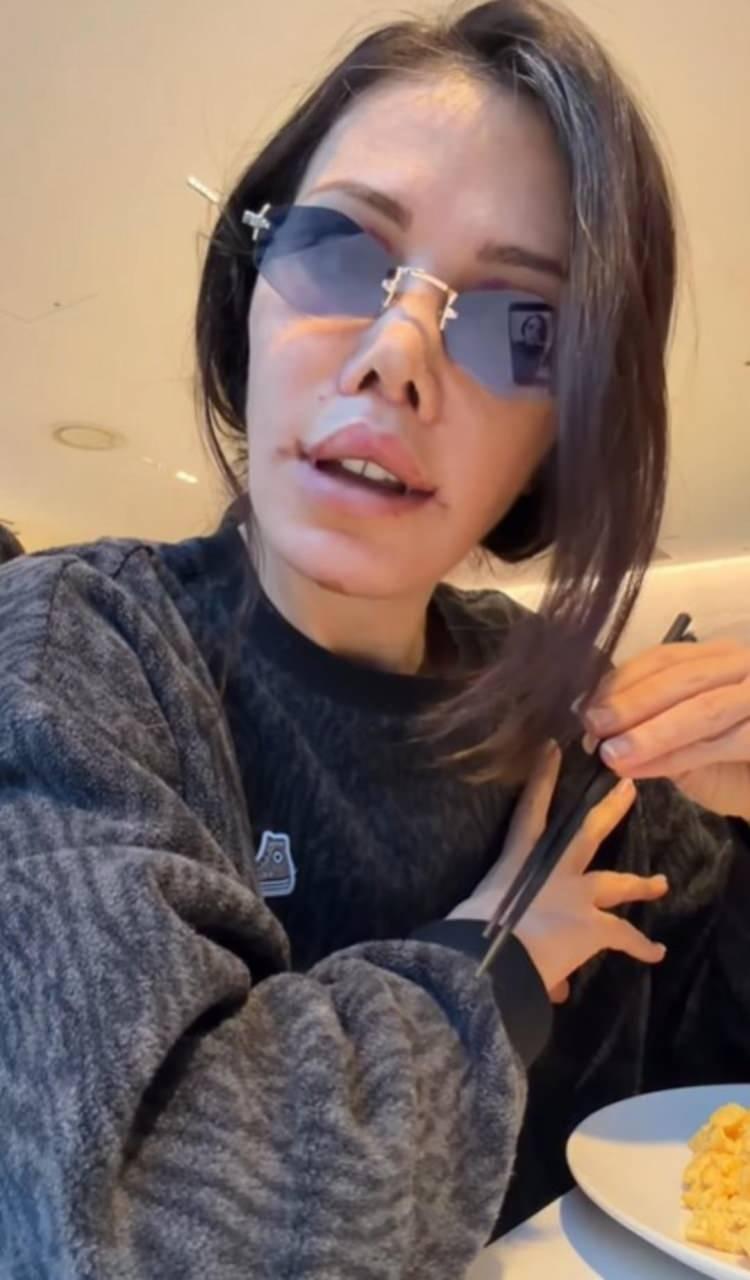 <p><span style="color:#B22222"><strong>"TEMİZLEME İŞLEMLERİ YAPILDI"</strong></span></p>

<p>Ameliyat sırasında temizleme işlemlerinin de yapıldığını dile getiren Ceran, "<strong>Derin y&uuml;z germe, g&ouml;z b&uuml;y&uuml;tme, dudak şekillendirme ve lifting gibi işlemler yapıldı"</strong> ifadelerini kullandı.</p>
