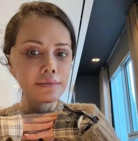 <p>Ceran, <strong>"Operasyon iki g&uuml;ne b&ouml;l&uuml;nd&uuml;. İlk g&uuml;n 4&ndash;5 saat, ikinci g&uuml;n yaklaşık 10 saat s&uuml;ren &ccedil;ok ağır bir cerrahi ge&ccedil;irdim buna rağmen hi&ccedil; ağrım olmadı' </strong>diye konuştu.</p>

<p>&nbsp;</p>
